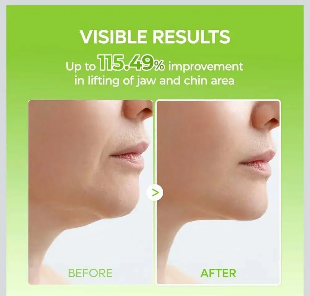 Dr. Melaxin Cactox Cooling V-Up Mask / V-Lifting Mewing Band, 4 Pack